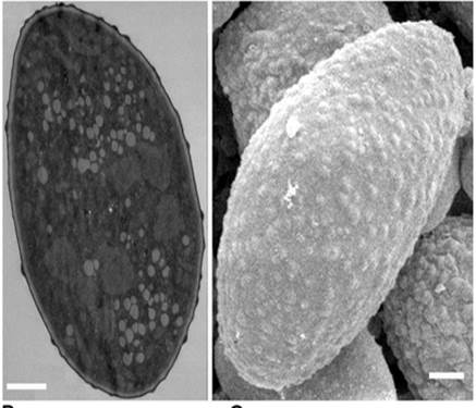 Microfotografías de granos de polen tomadas con TEM (izquierda) y SEM (derecha). La barra blanca representa 1 micrómetro. Tomada de http://www.plospathogens.org/article/info%3Adoi%2F10.1371%2Fjournal.ppat.1002086 