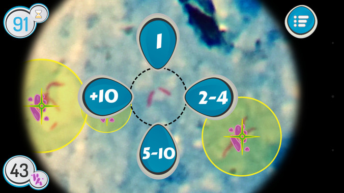 TuberSpot tuberculosis